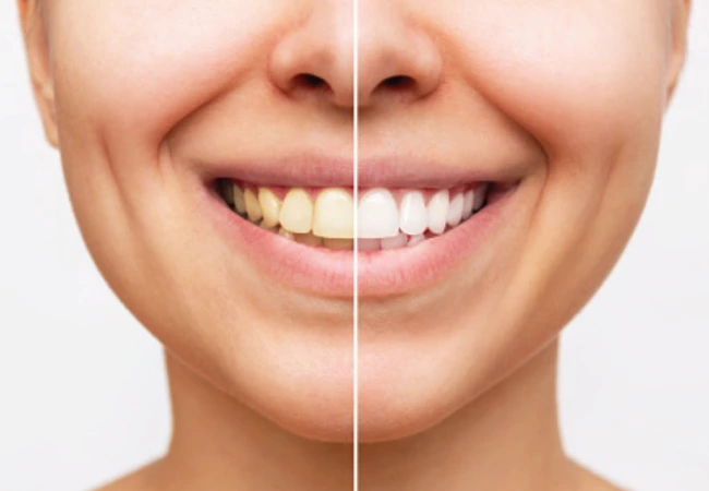 Seu Melhor Sorriso Começa Aqui